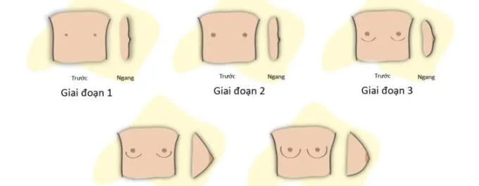 Etapes del desenvolupament dels pits segons l'edat