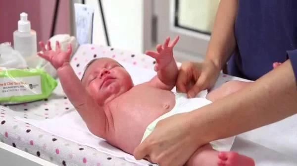 Nyfødt bæsj: Babyhelsemelding